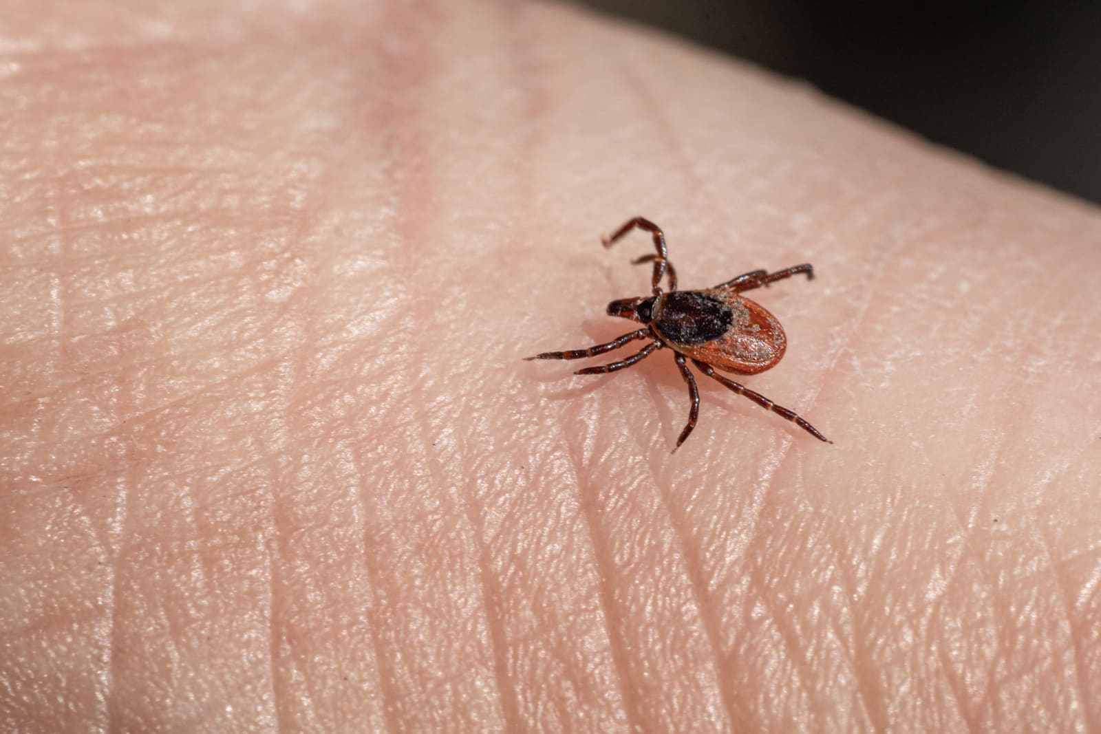 Tick on human skin close-up